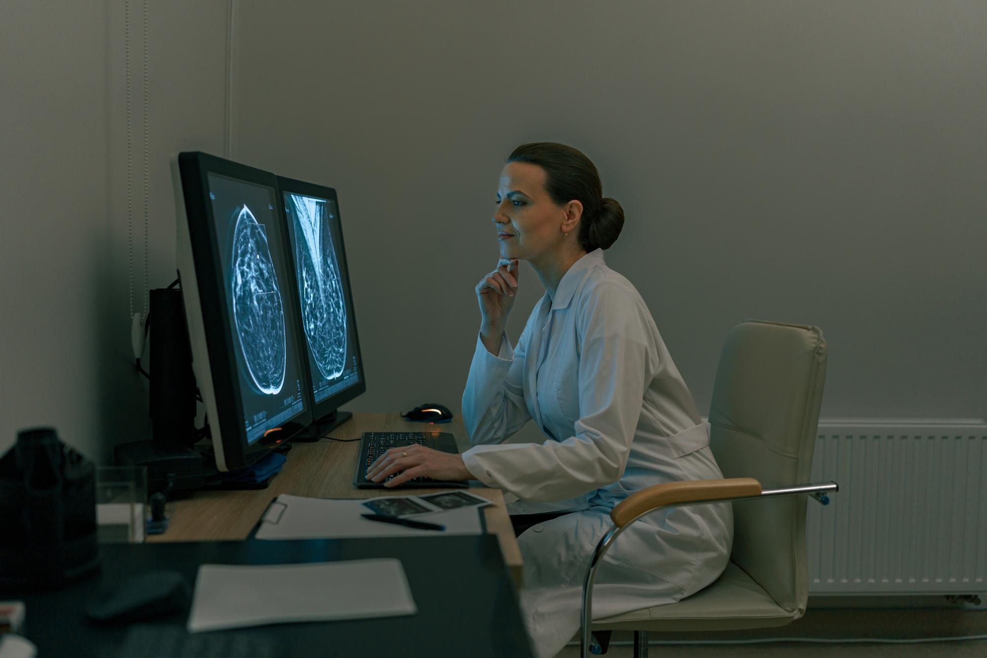 Physician reviewing brain imaging scans after a traumatic brain injury in Sacramento, California